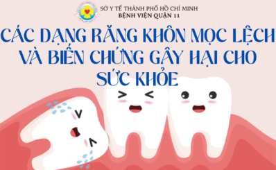 Các dạng răng khôn mọc lệch và biến chứng gây hại cho sức khỏe